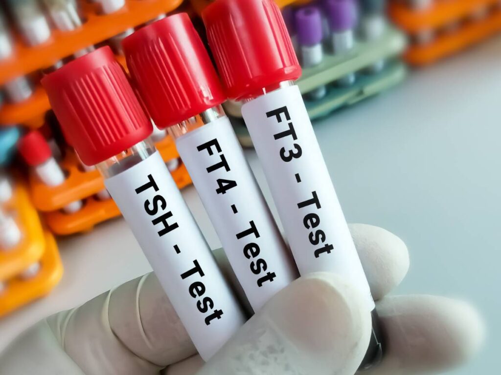 Dieta obniżająca TSH