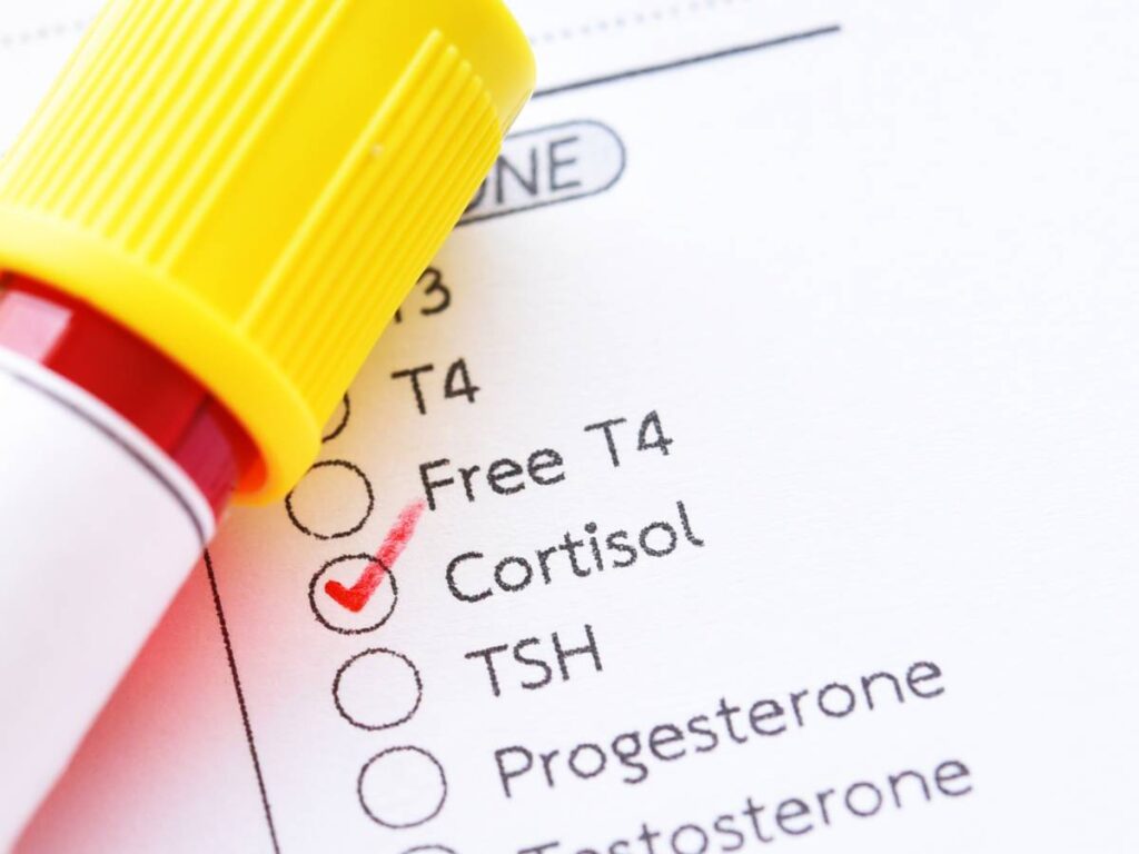Dieta obniżająca kortyzol