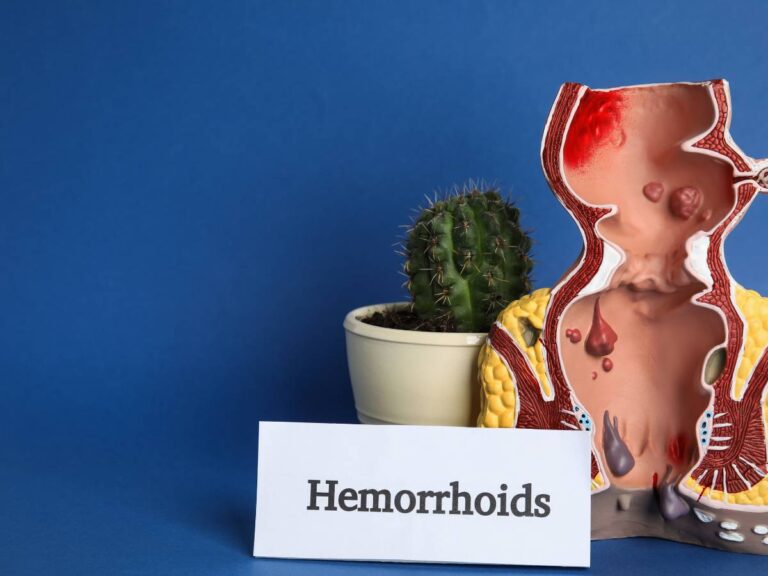 Dieta przy hemoroidach