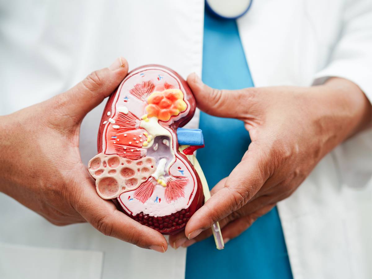 produkty na diecie przy kamicy nerkowej